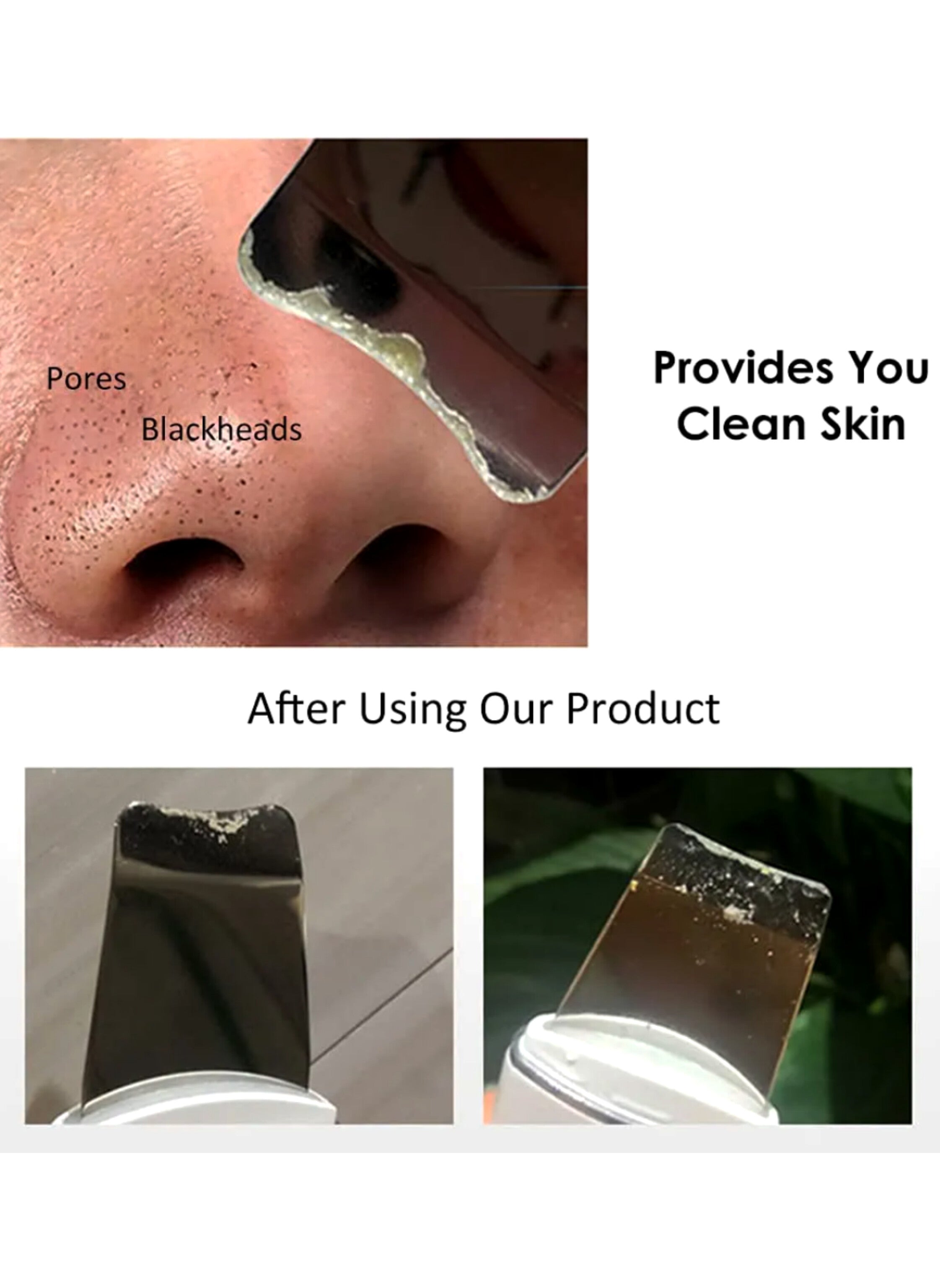 Facial exfoliating tool uses high-frequency vibration technology to effectively remove impurities.  اداة تقشير الوجه تعمل بتقنية الاهتزاز عالي التردد لإزالة الشوائب بفعالية.